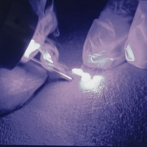 Milesman Blauman Láser Azul